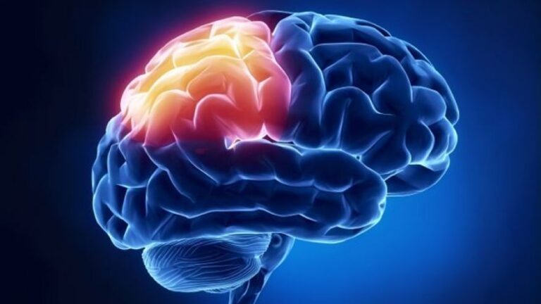 Contrecoup Brain Injury: Everything You Need to Know